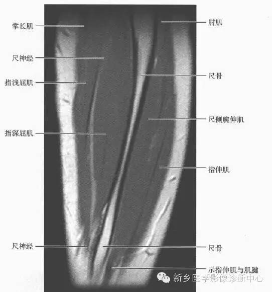 影像PPT - 前臂精细MR断层解剖标注-32