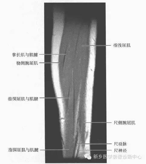 影像PPT - 前臂精细MR断层解剖标注-35