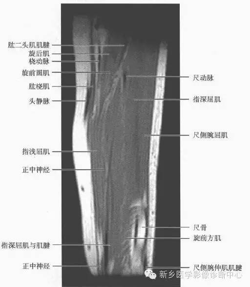 影像PPT - 前臂精细MR断层解剖标注-39