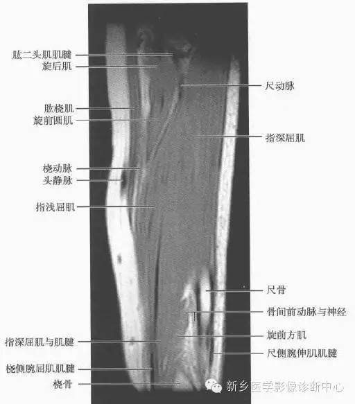 影像PPT - 前臂精细MR断层解剖标注-40