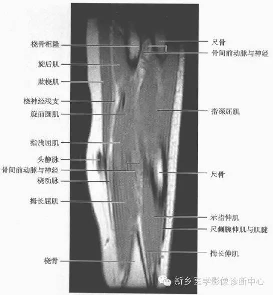 影像PPT - 前臂精细MR断层解剖标注-42