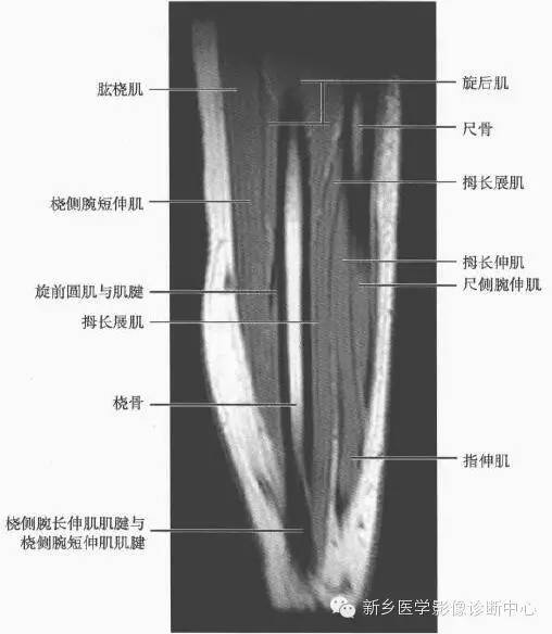 影像PPT - 前臂精细MR断层解剖标注-45