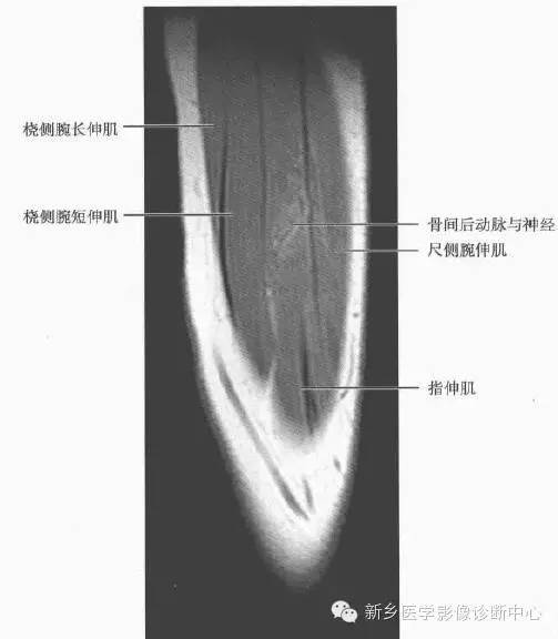 影像PPT - 前臂精细MR断层解剖标注-48