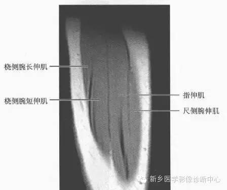 影像PPT - 前臂精细MR断层解剖标注-49