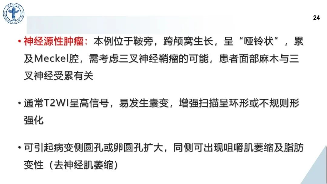 影像PPT - 【病例】鞍旁海绵窦高分化软骨肉瘤1例CT及MR影像-23