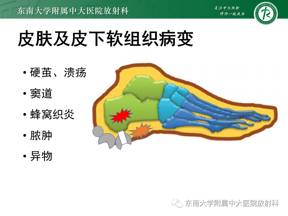 影像PPT - 【病例】糖尿病足2例MR影像-10 影像PPT - 【病例】糖尿病足2例MR影像-10