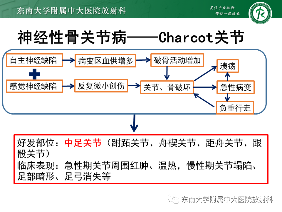影像PPT - 【病例】糖尿病足2例MR影像-18 影像PPT - 【病例】糖尿病足2例MR影像-18