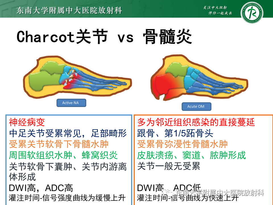 影像PPT - 【病例】糖尿病足2例MR影像-23 影像PPT - 【病例】糖尿病足2例MR影像-23