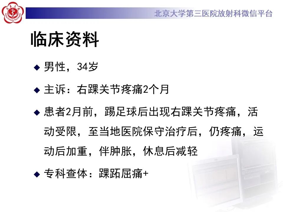 影像PPT - 【病例】踝关节后方撞击综合征1例X线CT及MR影像-2