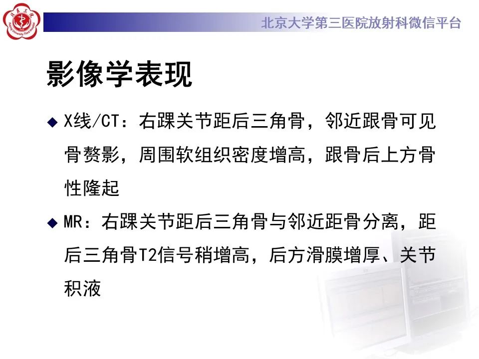 影像PPT - 【病例】踝关节后方撞击综合征1例X线CT及MR影像-8