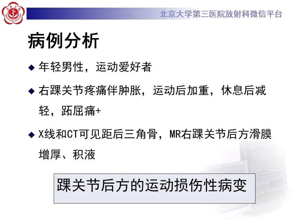 影像PPT - 【病例】踝关节后方撞击综合征1例X线CT及MR影像-9