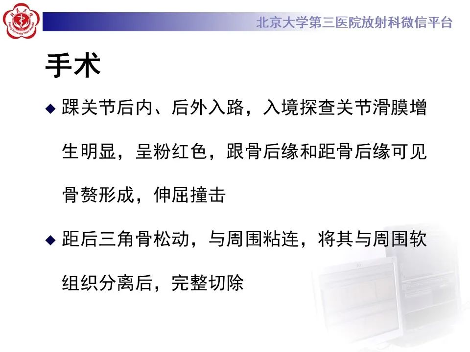 影像PPT - 【病例】踝关节后方撞击综合征1例X线CT及MR影像-10