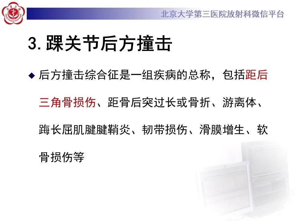 影像PPT - 【病例】踝关节后方撞击综合征1例X线CT及MR影像-17