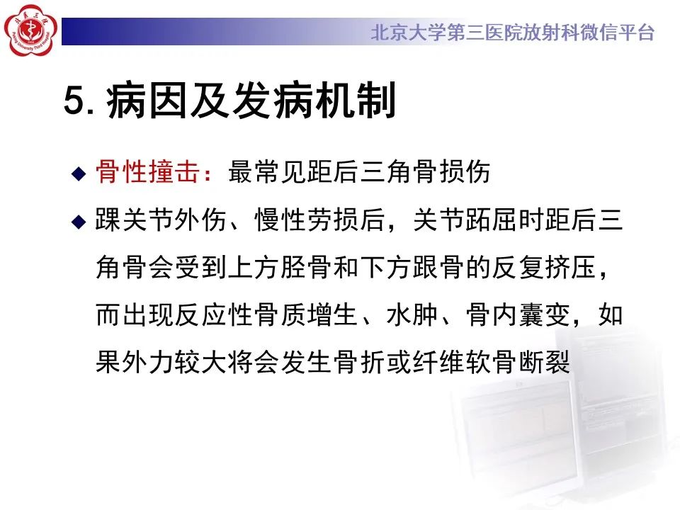 影像PPT - 【病例】踝关节后方撞击综合征1例X线CT及MR影像-22