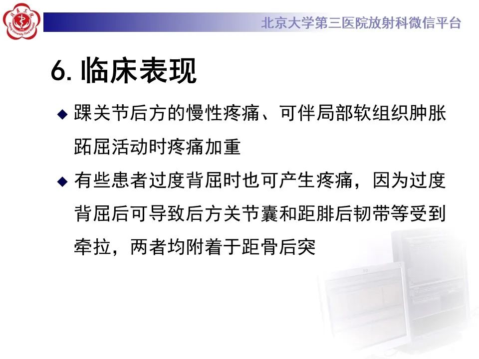 影像PPT - 【病例】踝关节后方撞击综合征1例X线CT及MR影像-25