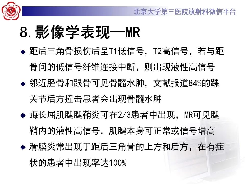 影像PPT - 【病例】踝关节后方撞击综合征1例X线CT及MR影像-28