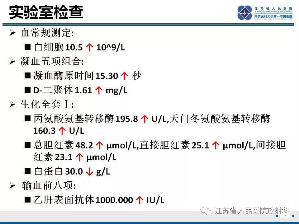 影像PPT - 【病例】肝小静脉闭塞病HVOD一例CT影像-3