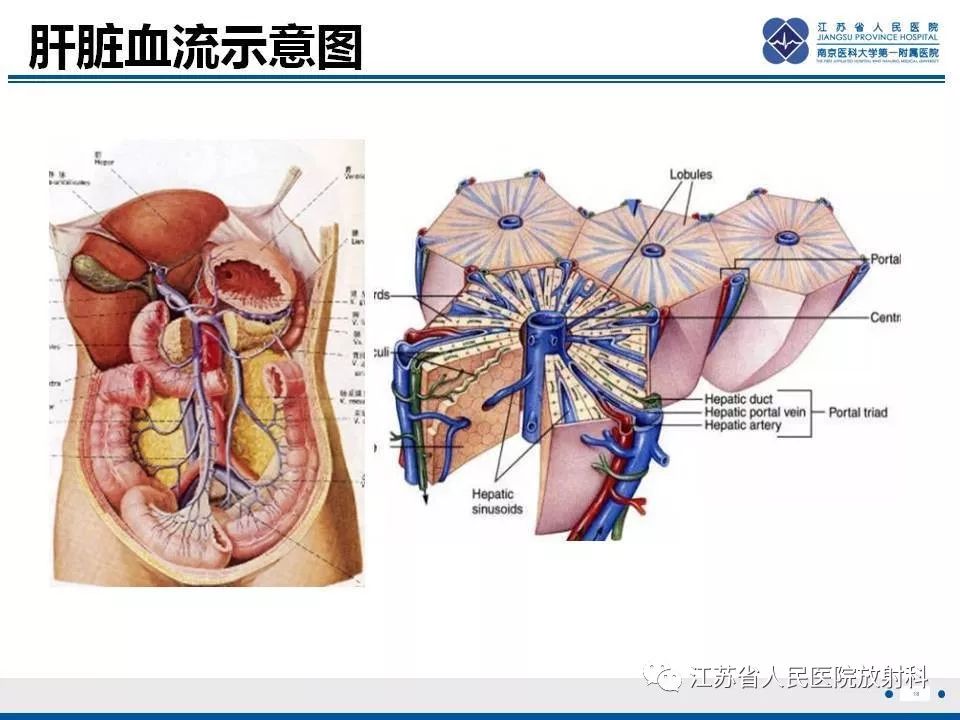 影像PPT - 【病例】肝小静脉闭塞病HVOD一例CT影像-19