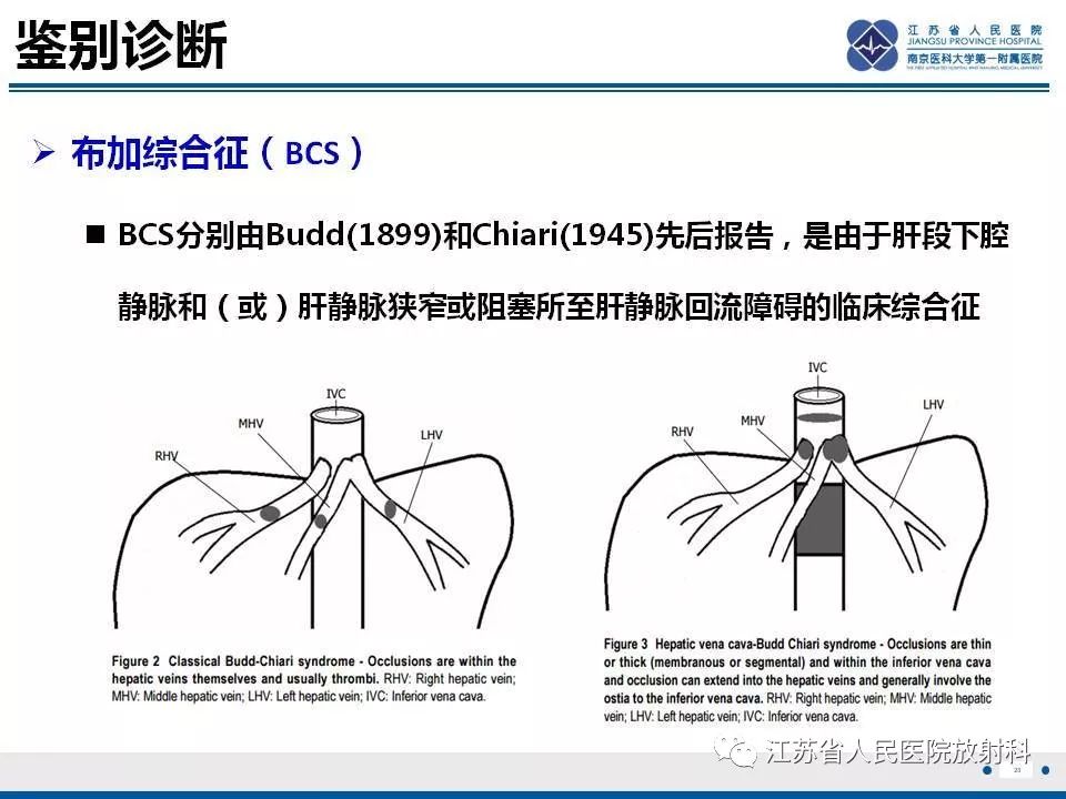 影像PPT - 【病例】肝小静脉闭塞病HVOD一例CT影像-24