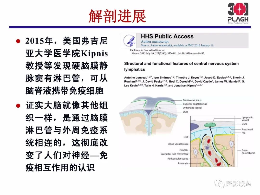 影像PPT - 【PPT】不典型原发中枢神经系统淋巴瘤影像诊断思路-2