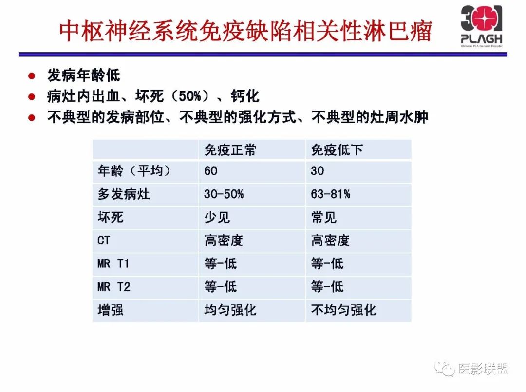 影像PPT - 【PPT】不典型原发中枢神经系统淋巴瘤影像诊断思路-28