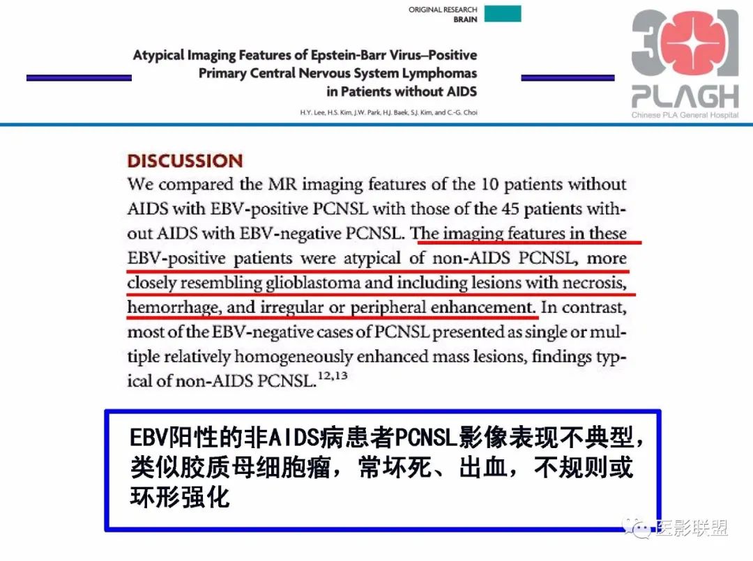 影像PPT - 【PPT】不典型原发中枢神经系统淋巴瘤影像诊断思路-30