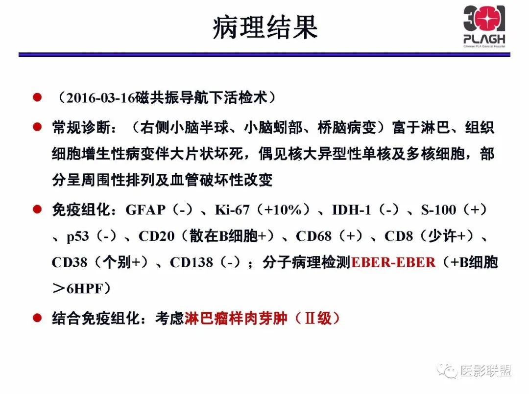 影像PPT - 【PPT】不典型原发中枢神经系统淋巴瘤影像诊断思路-43