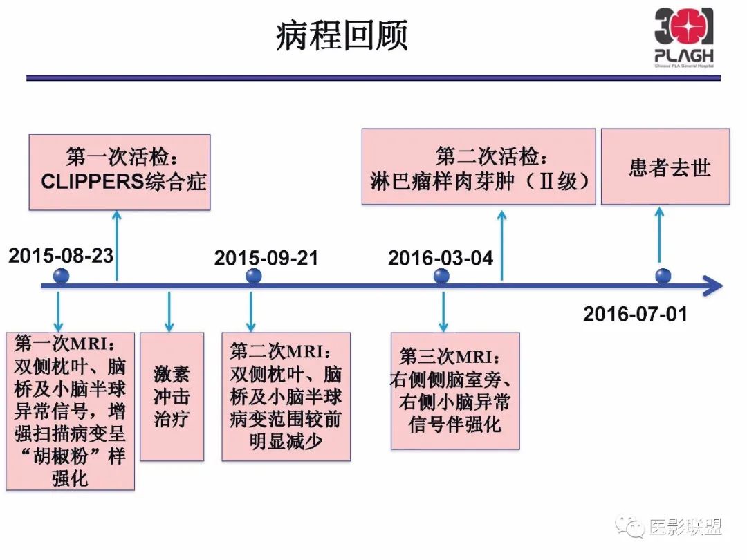 影像PPT - 【PPT】不典型原发中枢神经系统淋巴瘤影像诊断思路-44