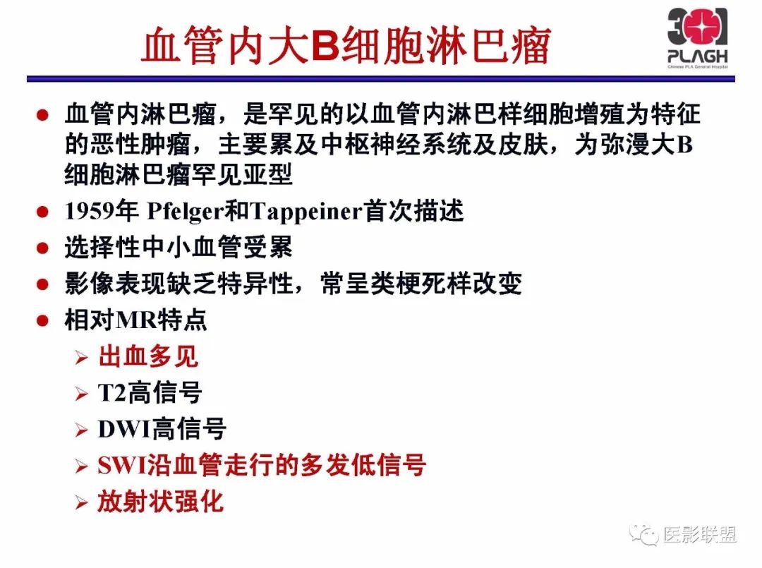 影像PPT - 【PPT】不典型原发中枢神经系统淋巴瘤影像诊断思路-48