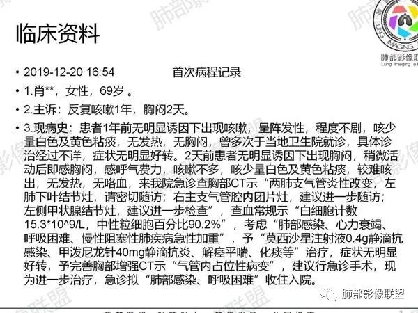 影像PPT - 【病例】气管腺样囊性癌1例CT影像讨论-72 影像PPT - 【病例】气管腺样囊性癌1例CT影像讨论-72