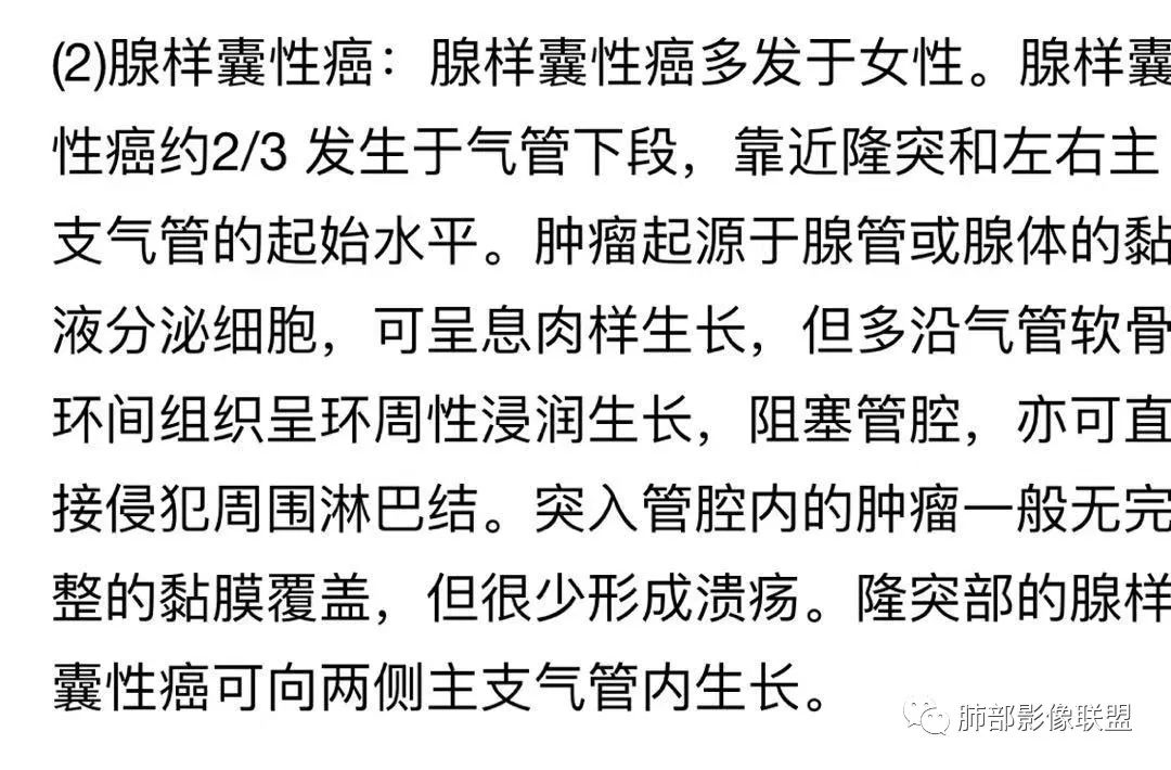 影像PPT - 【病例】气管腺样囊性癌1例CT影像讨论-89 影像PPT - 【病例】气管腺样囊性癌1例CT影像讨论-89
