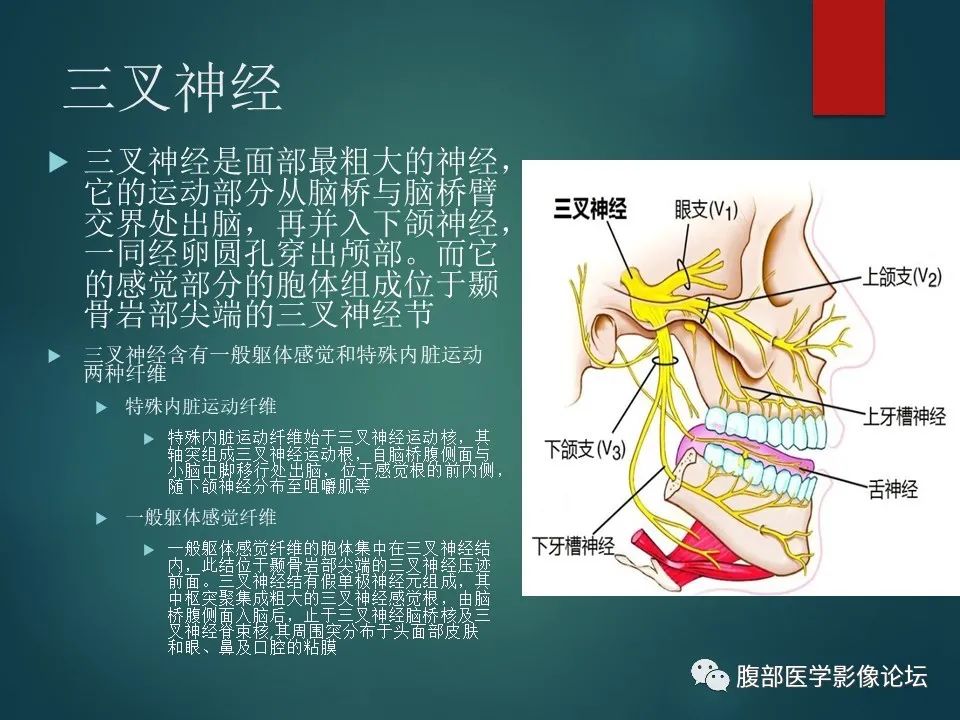影像PPT - 【PPT】三叉孔道弯弯绕-2 影像PPT - 【PPT】三叉孔道弯弯绕-2