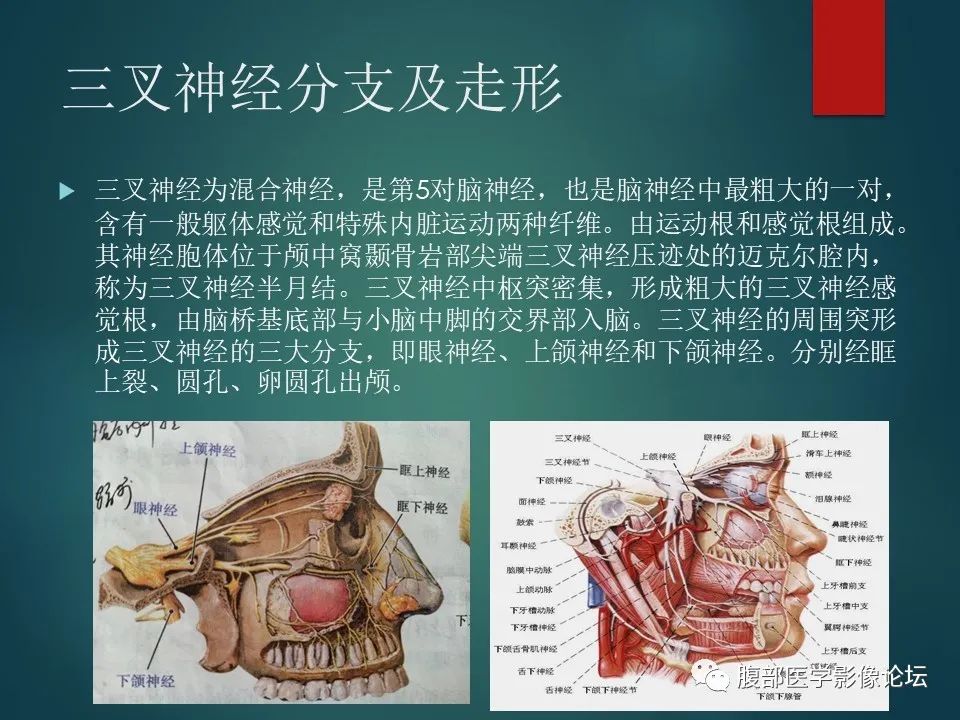 影像PPT - 【PPT】三叉孔道弯弯绕-3 影像PPT - 【PPT】三叉孔道弯弯绕-3