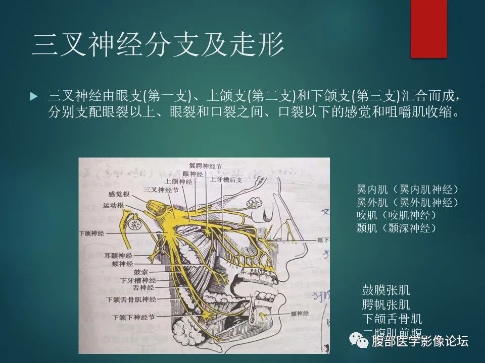 影像PPT - 【PPT】三叉孔道弯弯绕-5 影像PPT - 【PPT】三叉孔道弯弯绕-5