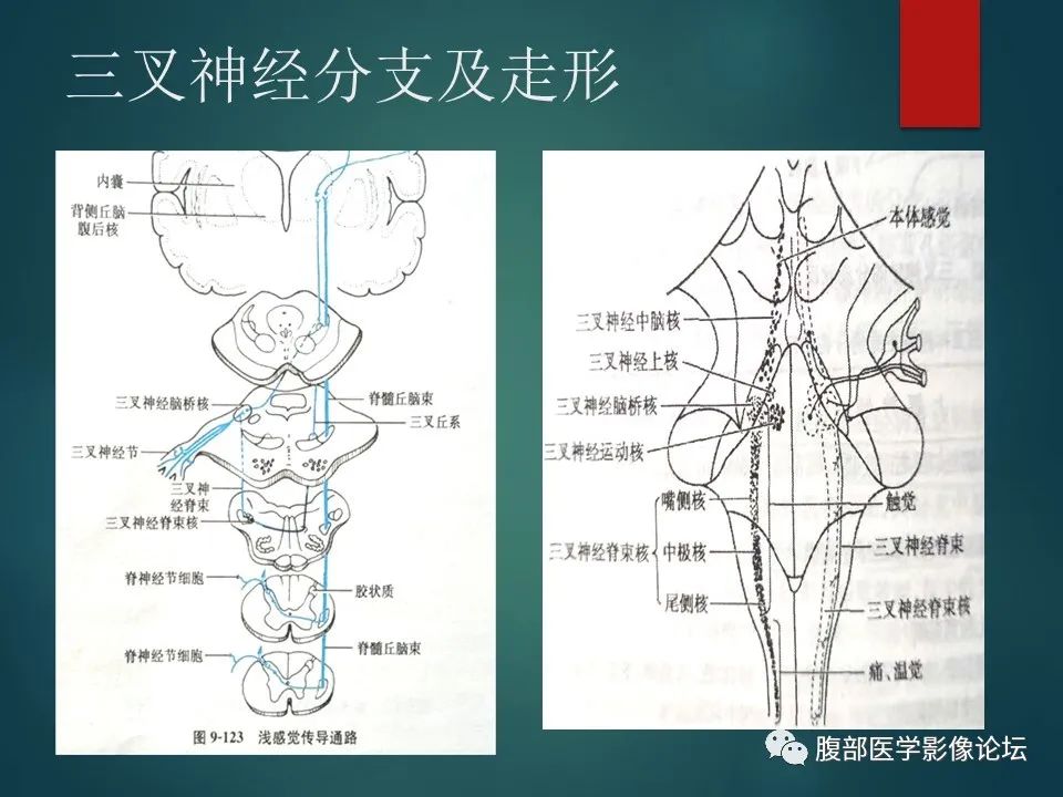 影像PPT - 【PPT】三叉孔道弯弯绕-6 影像PPT - 【PPT】三叉孔道弯弯绕-6