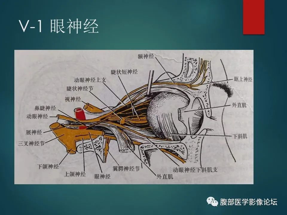 影像PPT - 【PPT】三叉孔道弯弯绕-10 影像PPT - 【PPT】三叉孔道弯弯绕-10