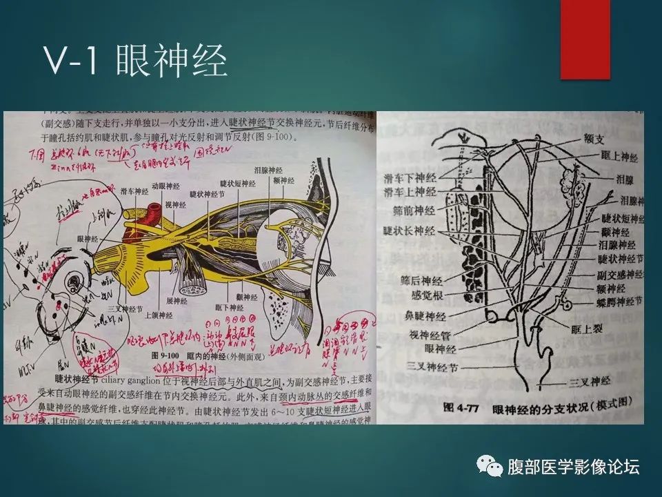 影像PPT - 【PPT】三叉孔道弯弯绕-11 影像PPT - 【PPT】三叉孔道弯弯绕-11