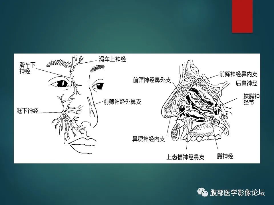 影像PPT - 【PPT】三叉孔道弯弯绕-12 影像PPT - 【PPT】三叉孔道弯弯绕-12