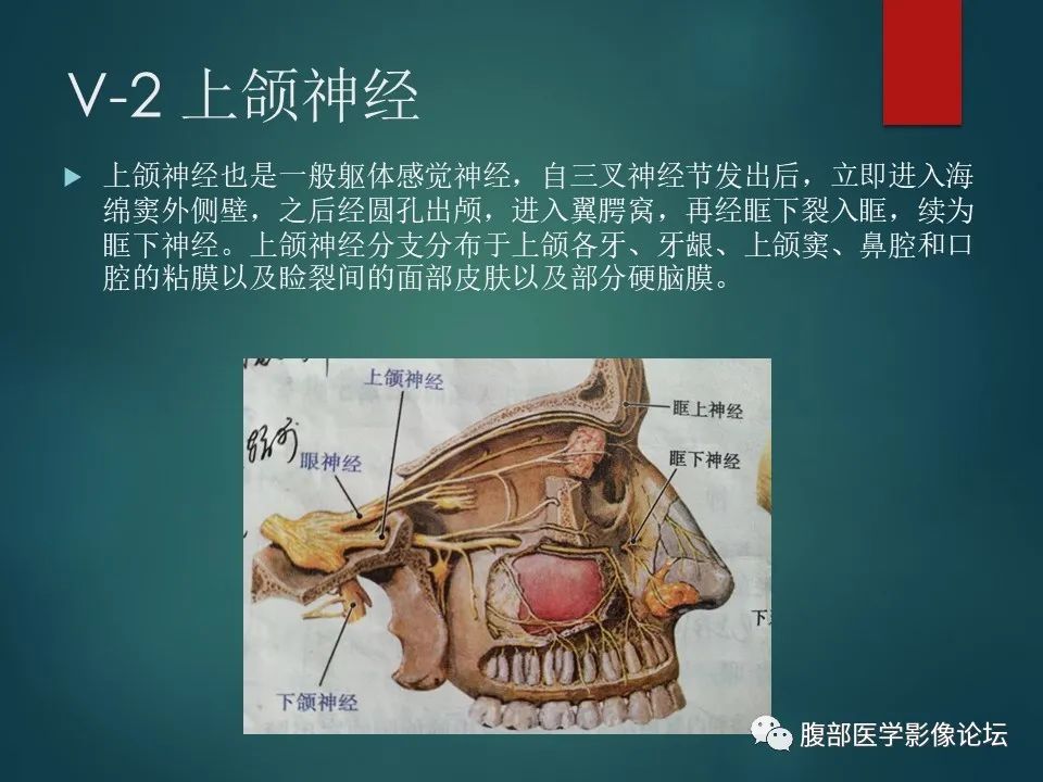 影像PPT - 【PPT】三叉孔道弯弯绕-13 影像PPT - 【PPT】三叉孔道弯弯绕-13