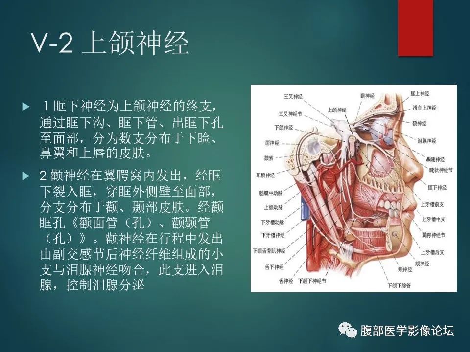 影像PPT - 【PPT】三叉孔道弯弯绕-14 影像PPT - 【PPT】三叉孔道弯弯绕-14