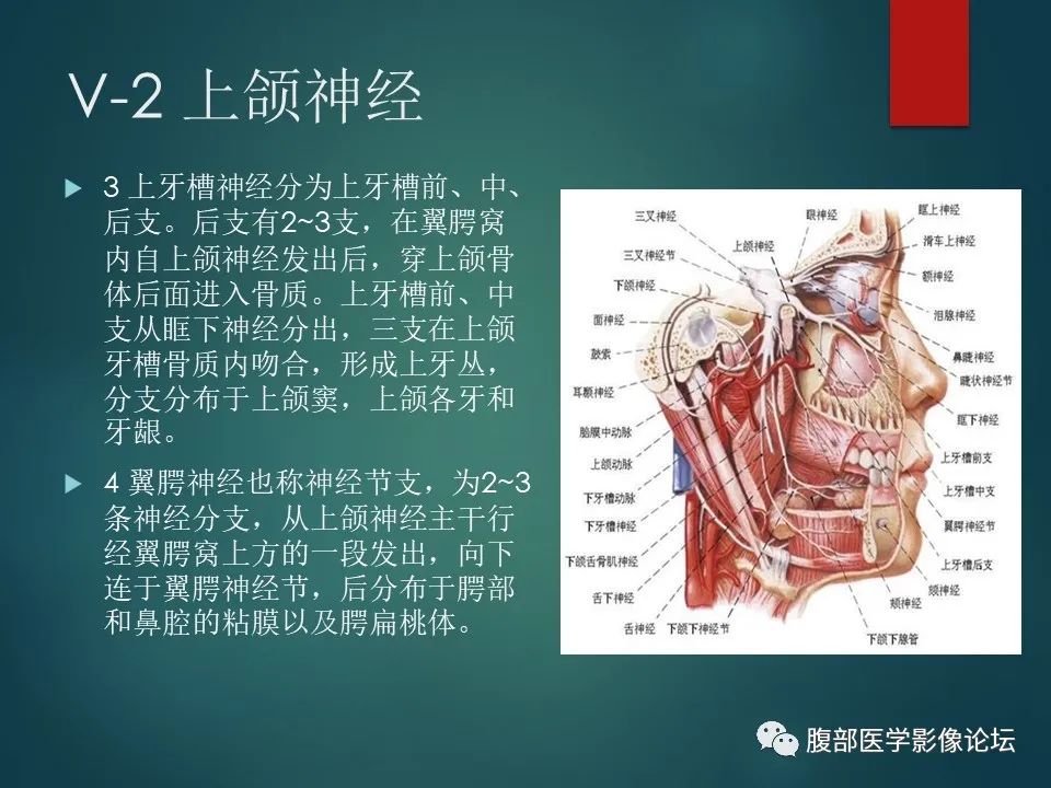 影像PPT - 【PPT】三叉孔道弯弯绕-15 影像PPT - 【PPT】三叉孔道弯弯绕-15