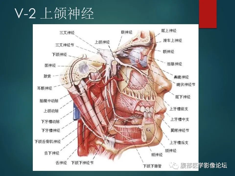 影像PPT - 【PPT】三叉孔道弯弯绕-17 影像PPT - 【PPT】三叉孔道弯弯绕-17