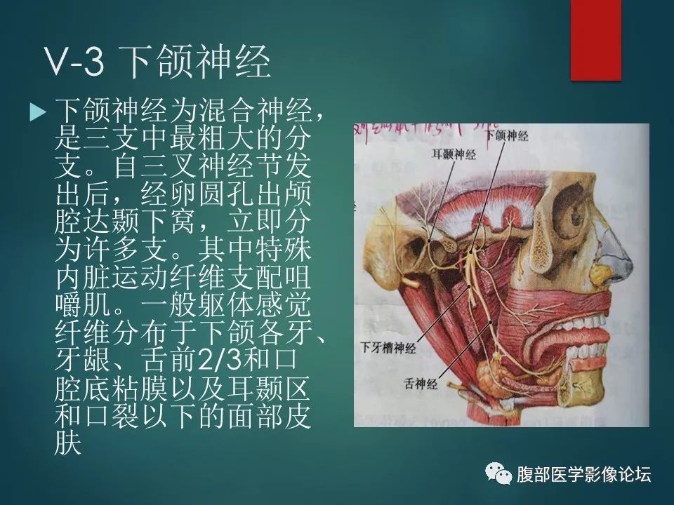 影像PPT - 【PPT】三叉孔道弯弯绕-18 影像PPT - 【PPT】三叉孔道弯弯绕-18