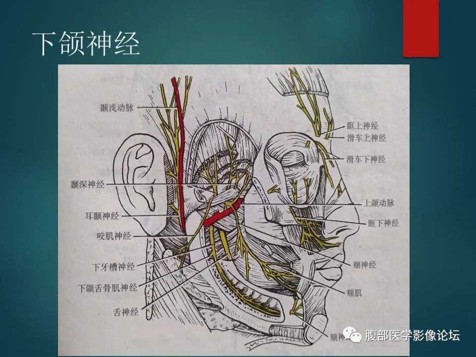 影像PPT - 【PPT】三叉孔道弯弯绕-21 影像PPT - 【PPT】三叉孔道弯弯绕-21