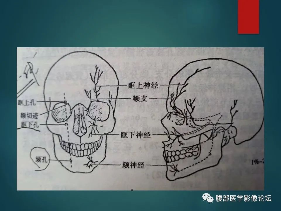 影像PPT - 【PPT】三叉孔道弯弯绕-22 影像PPT - 【PPT】三叉孔道弯弯绕-22