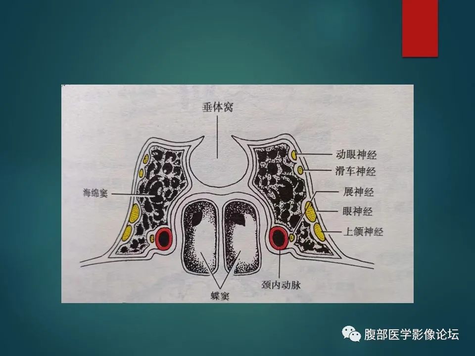 影像PPT - 【PPT】三叉孔道弯弯绕-24 影像PPT - 【PPT】三叉孔道弯弯绕-24