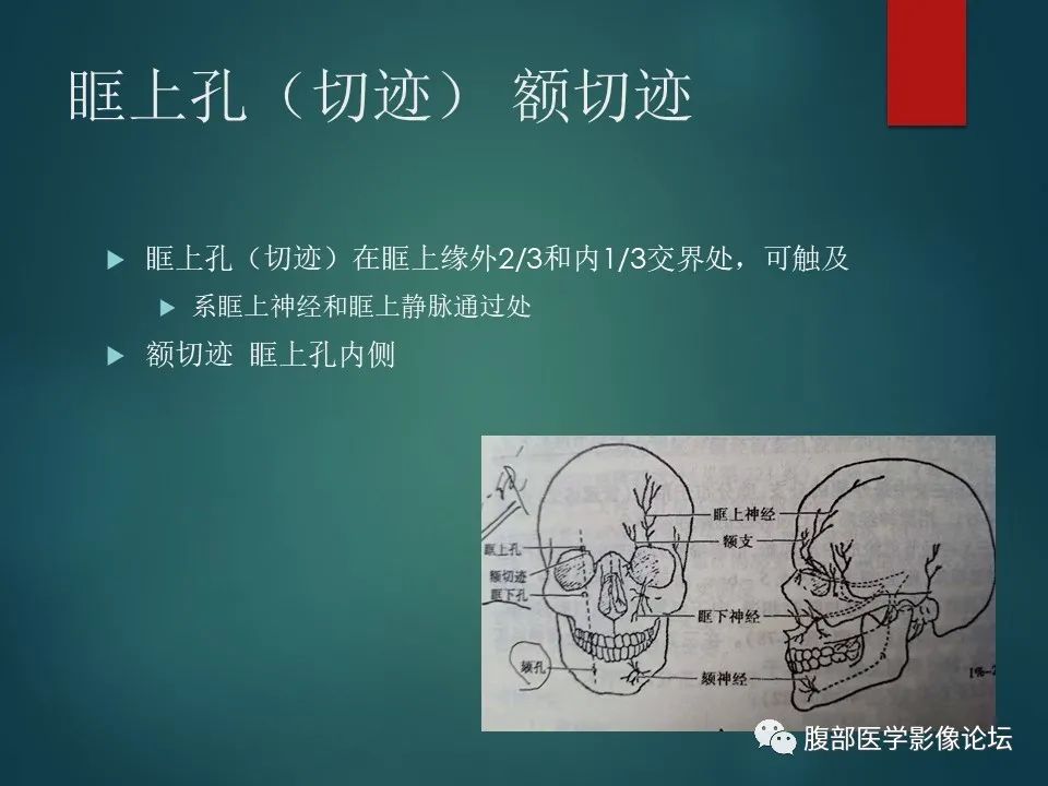 影像PPT - 【PPT】三叉孔道弯弯绕-43 影像PPT - 【PPT】三叉孔道弯弯绕-43