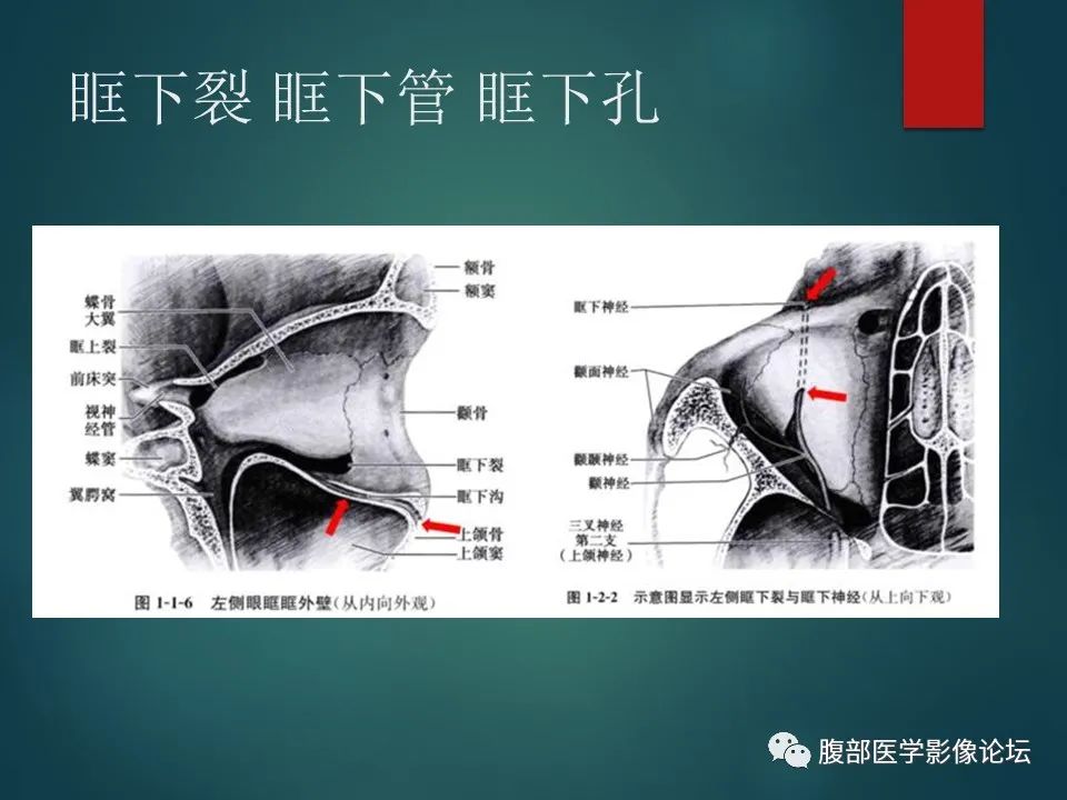 影像PPT - 【PPT】三叉孔道弯弯绕-60 影像PPT - 【PPT】三叉孔道弯弯绕-60