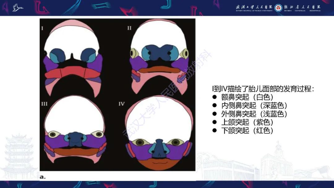 影像PPT - 【PPT】胎儿面部畸形MR诊断-12