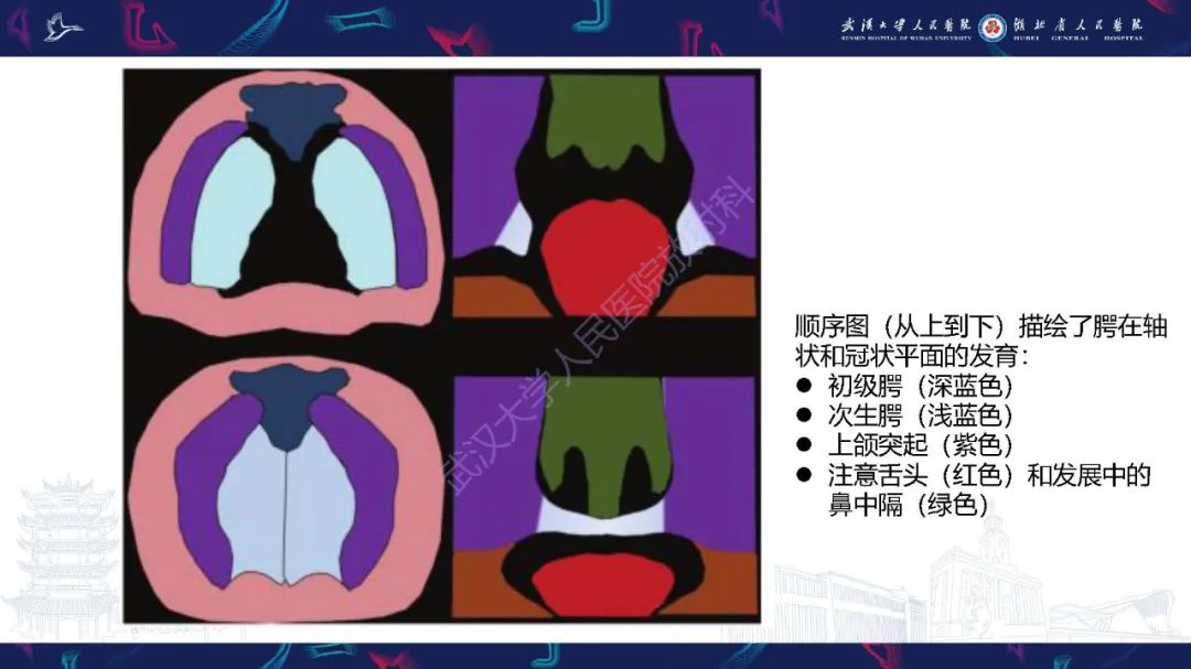 影像PPT - 【PPT】胎儿面部畸形MR诊断-15